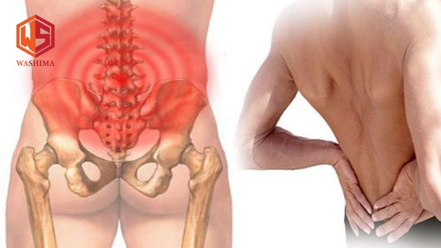 Một số nguyên nhân dẫn đến đau lưng dưới gần mông