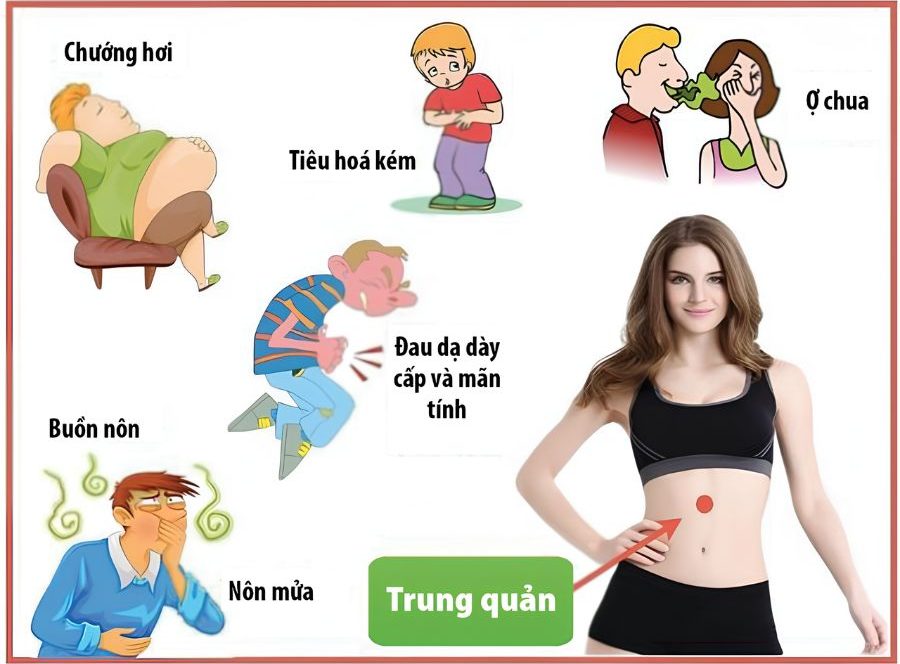 Huyệt Trung Quản