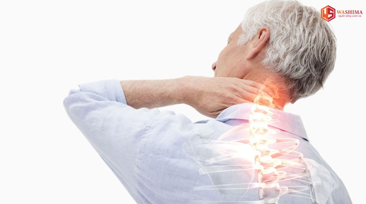 Đau cổ vai gáy nhức đầu là bệnh gì?