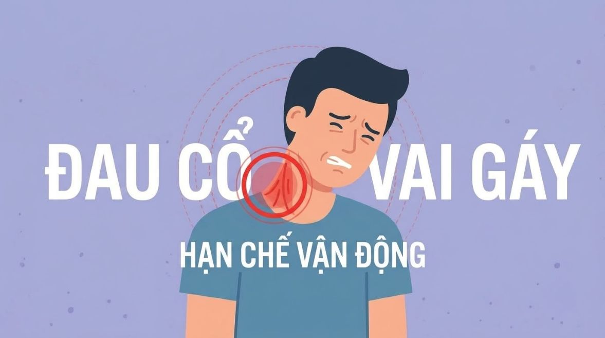 Cổ vai bị cứng