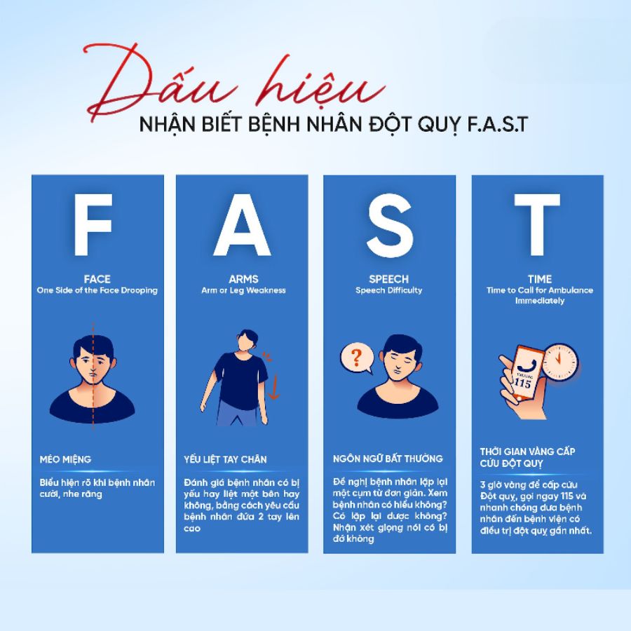 Cách sơ cứu đột quỵ khi có dấu hiệu bất thường