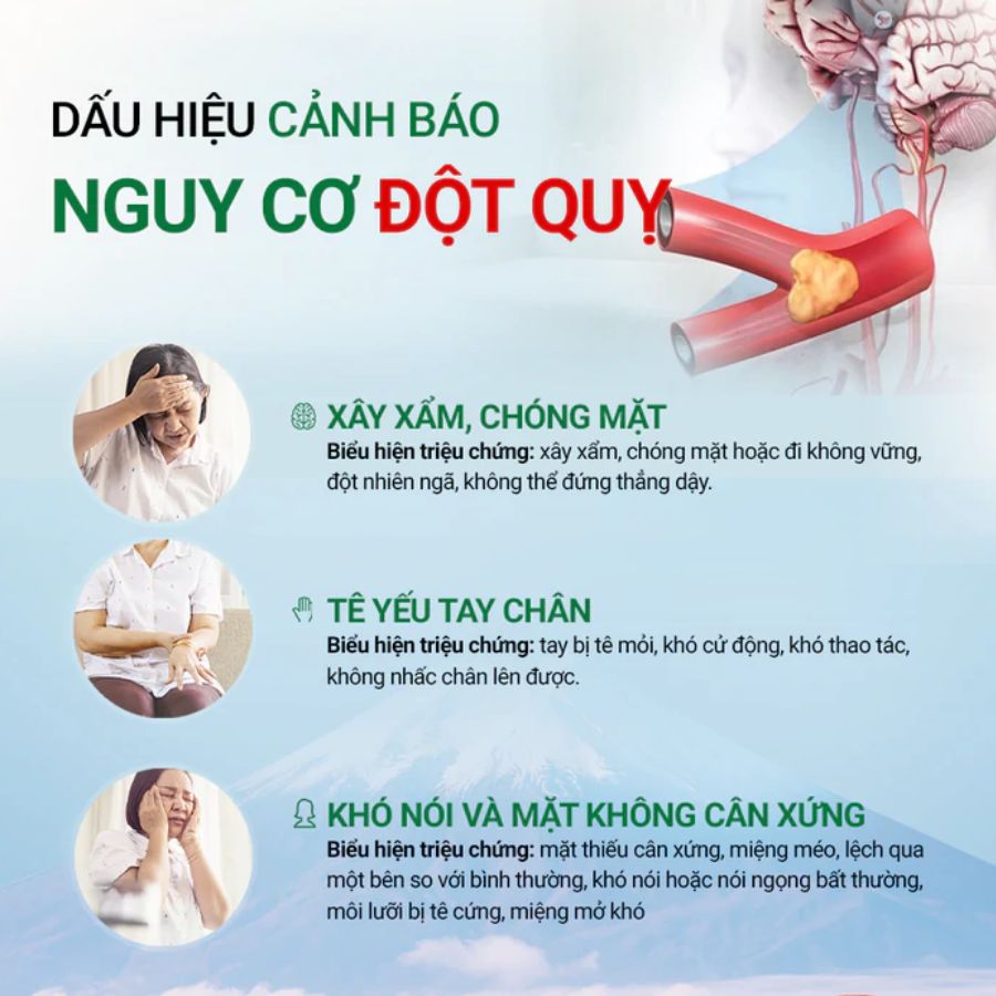 Nhận Biết Sớm Dấu Hiệu Đột Quỵ