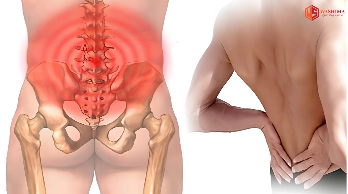 Đau lưng dưới thắt lưng là gì?