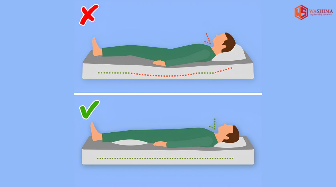 Khi nào đau lưng cần đi khám bác sĩ?